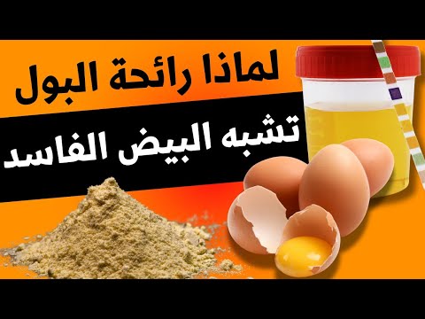 22 سبب رائحة البول مثل البيض الفاسد أو الكبريت     