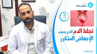 تجلط الدم الذي يسبب الاجهاض المتكرر - د. مظهر عطية