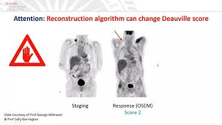 Evolution of Radiation in Hodgkin Lymphoma_Dr Rahul R.  Parikh, MD
