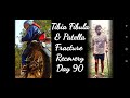 Tibia fibula  patella fracture recovery day 90  walking with stick    