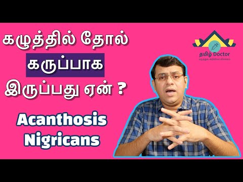 Video: Kan swangerskap acanthosis nigricans veroorsaak?