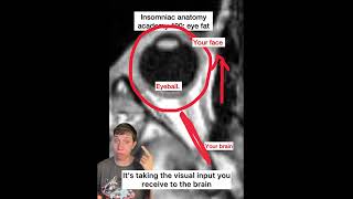 Insomniac anatomy academy 400: eye fat #science #stem #anatomy #sciencefacts #eyes