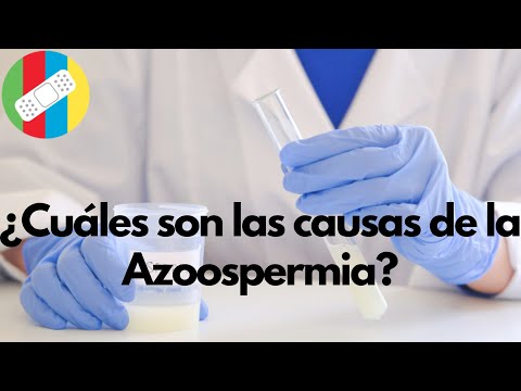 Vídeo: Azoospermia: Tratamiento, Causas, Síntomas Y Más