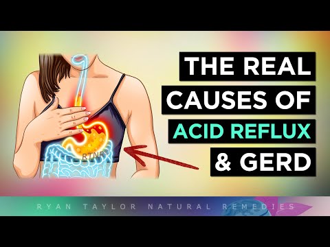 The REAL Causes of ACID REFLUX