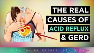 The REAL Causes of ACID REFLUX by Ryan Taylor (Natural Remedies) 9,906 views 2 months ago 10 minutes, 32 seconds