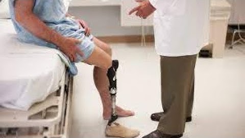 Amputation Leg CPT code - simplify medical coding