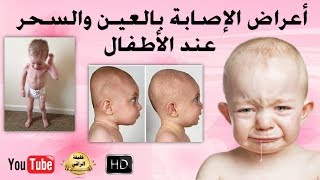 أعراض الإصابة بالعين والسحر عند الرضع والأطفال
