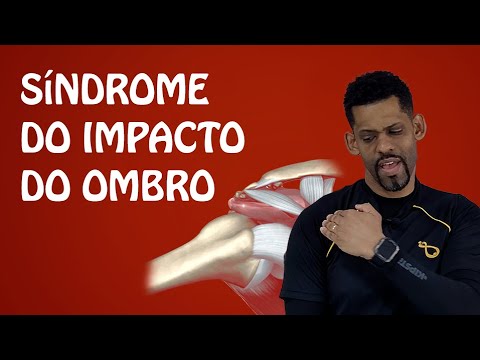 Tudo sobre a Síndrome do impacto do Ombro - Exercícios para alivio das dores crônicas nos ombros