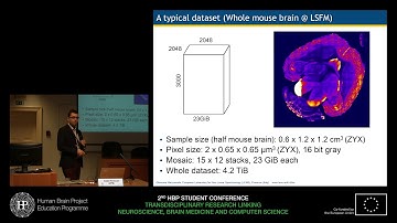 Mazzamuto Giacomo - A software pipeline for efficient processing of 3D high-resolution (...)