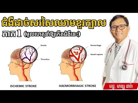 ជំងឺដាច់សរសៃឈាមខួរក្បាល Stroke (1/3)| វេជ្ជបណ្ឌិត ហង្ស ដារ៉ា | success knowledge