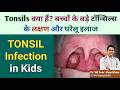 टॉन्सिल क्या होते हैं? Home Remedies for Tonsils in Children | Dr Md Noor Alam Khan