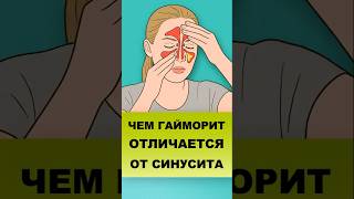ЧЕМ ГАЙМОРИТ ОТЛИЧАЕТСЯ ОТ СИНУСИТА #синусит #гайморит