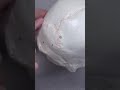 sutures of skull( anatomy)