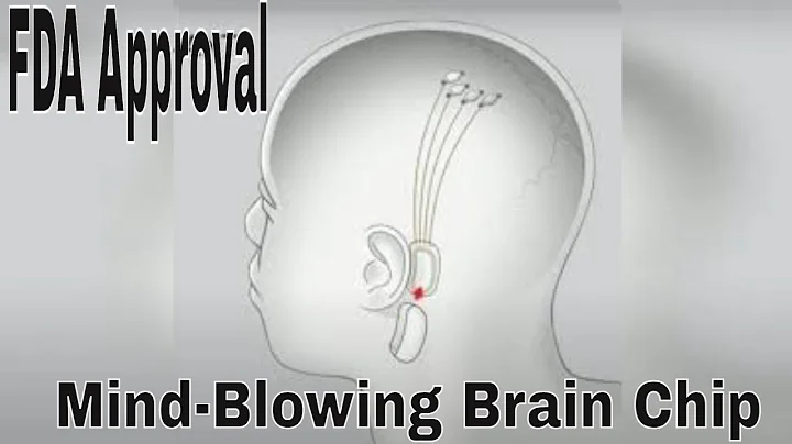 Elon Musk's Neuralink: FDA Approves Mind-Blowing Brain Chip