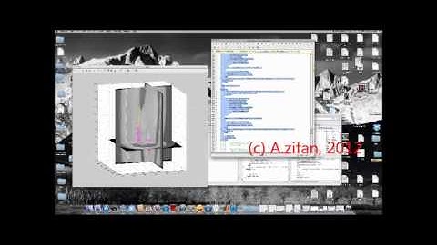Segmentation of the Aorta