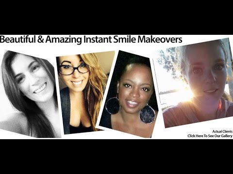 press-on-dental-veneers-online---4-real-client-reviews