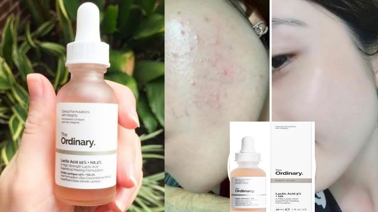 lactic acid the ordinary how to use lactic acid the ordinary how to