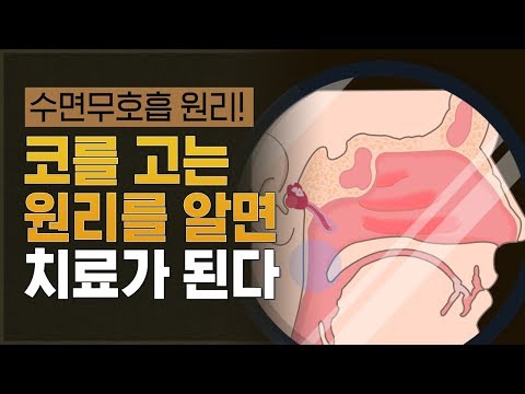 종이 한장으로 알아보는 코골이 수면무호흡 원리, 알고 치료하자