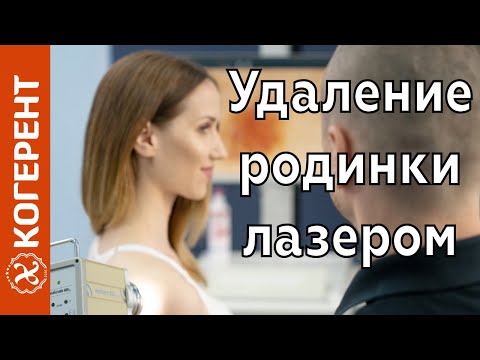Безболезненное удаление родинки лазером. Когерент — клиника лазерной терапии и косметологии