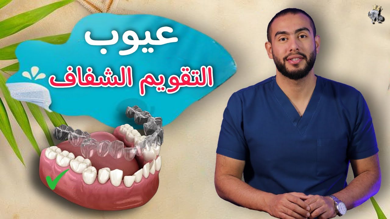 مميزات وعيوب التقويم الشفاف🥳 | اشياء يجب ان تعرفها قبل عمل التقويم الشفاف🦷 | ومده استخدامه 💯