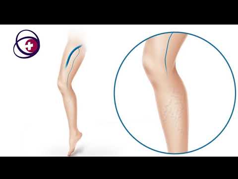 გორის სამედიცინო ცენტრი