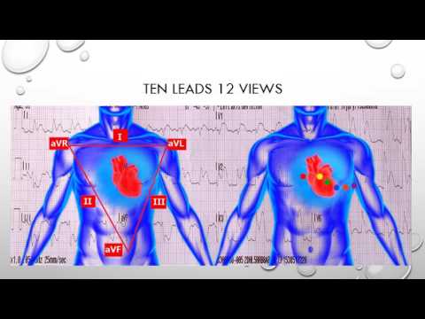 12 Lead ECG Episode 2 - Lead Placement - YouTube