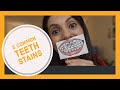 WHAT CAUSES TEETH STAINS ? HOW TO GET RID OF TEETH STAINS ?