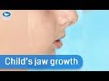 Will my child&#39;s jaw grow?