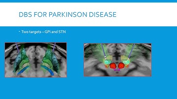 Deep Brain Stimulation for Movement Disorders