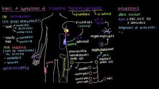 Detailed What is essential thrombocythemia? Information