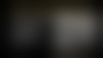 Masterclass #3 : Advanced Techniques in Anterior Hip Replacement