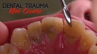 Dental Trauma Mini-Course - Part 2 - Dental Trauma Worksheet