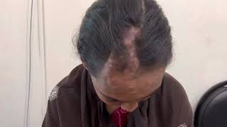 An Interesting case of Sinus Pericranii