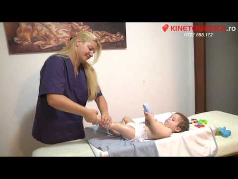 Video: ❶ Picior De Club Congenital La Copii