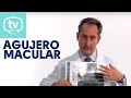 ¿En qué consiste y cómo se trata el agujero macular?