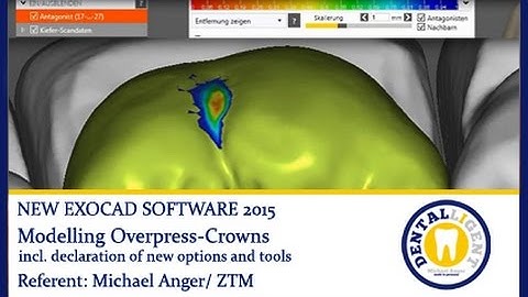 EXOCAD TUTORIALS - ENGLISH - Modelling Overpress Crowns by Michael Anger