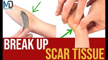 How To Break Up Scar Tissue - 6 Effective Methods