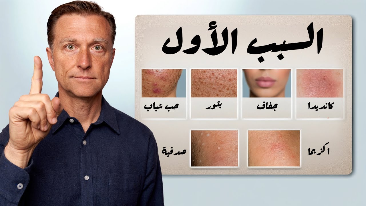 النقص الأكثر شيوعًا في كل أمراض الجلد