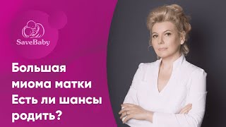 Большая миома матки. Есть ли шансы родить? Акушер-гинеколог