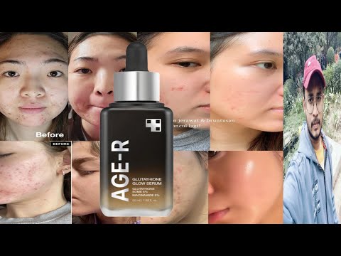 medicube glutathione glow serum reviews Age R | Honest Review Buy Macrofol Vitamin B12