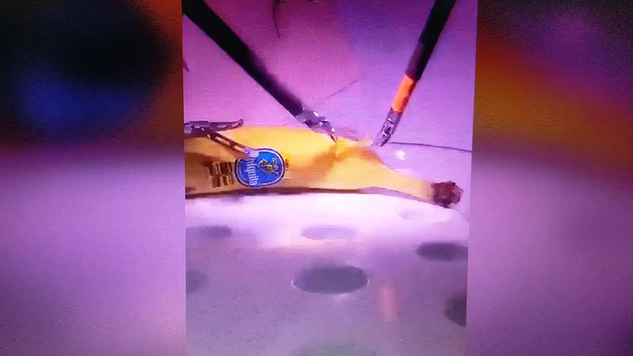 Remote surgery by a London surgeon on a banana in California with 5G