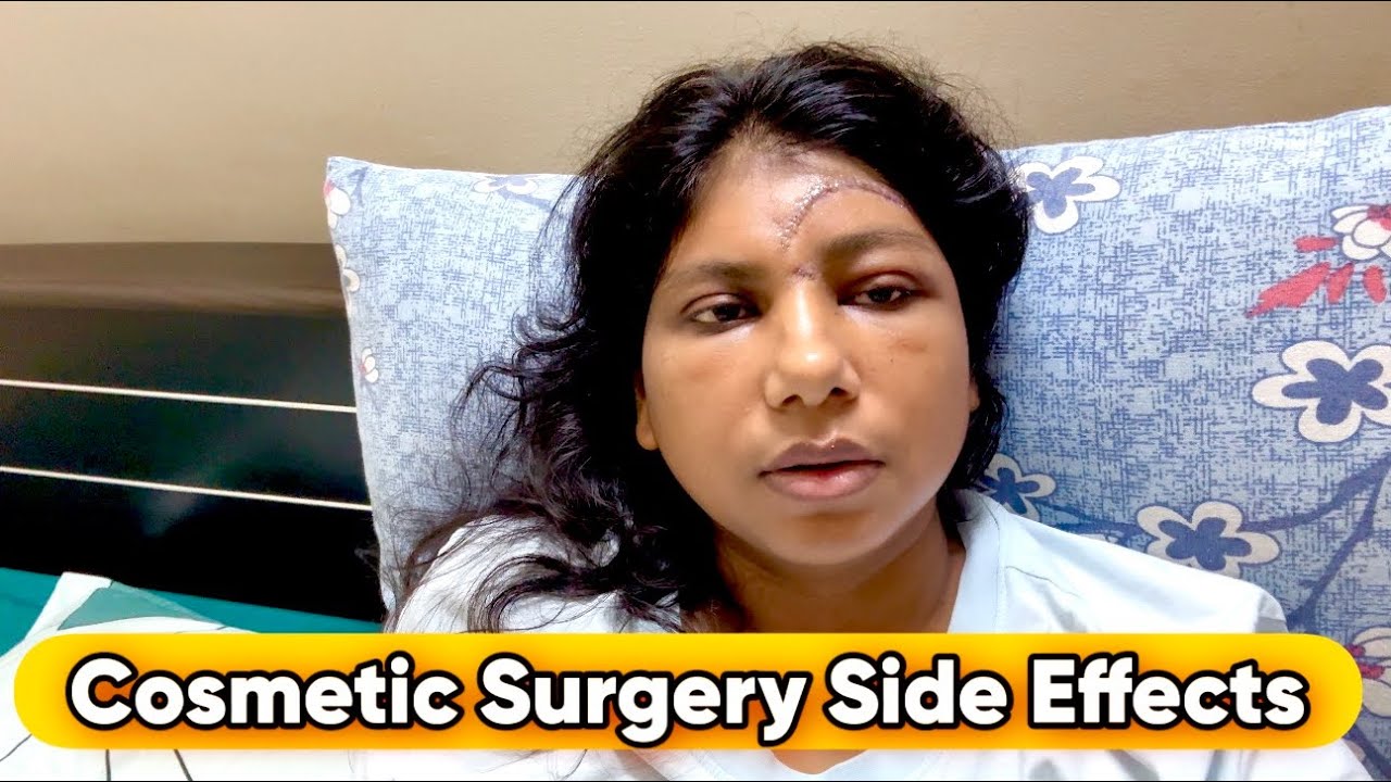 Cosmetic Surgery karwaya /Scar Revision Surgery 