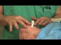 Lesson 8 - Surgical Airway: MICU Fellows Airway Course