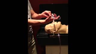 LTA Stylet Intubation 2 - alternate grip