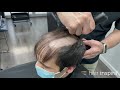 Aplicación de prótesis capilar hombre (antes y después) - Hair System fitting video (Kevin)