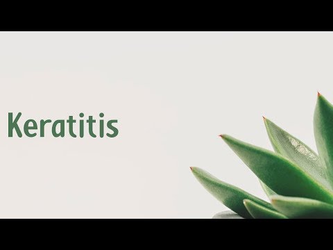 Video: Keratitis - Traumatični Keratitis, Simptomi I Liječenje