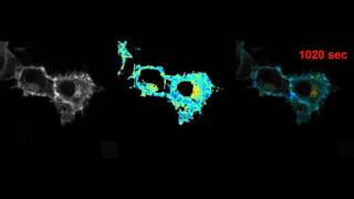 FRET imaging with PF32 SPAD camera
