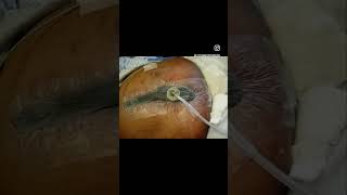 Important surgical instruments for #neetpg #inicet #fmge #norcet #mrcs exams | Dr. Rohan Khandelwal