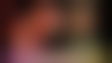 Left Hepatectomy with Caudate Lobectomy For Hilar Cholangiocarcinoma  | Dr Hitesh Chavda