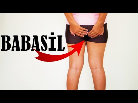 Babasil (hemorroy) təbii yolla müalicəsi
